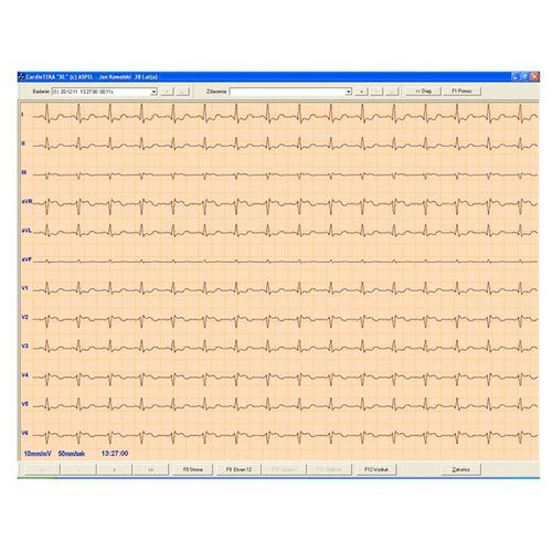 Программное обеспечение для электрокардиографии - CARDIOTEKA v.211SOFT - ASPEL  - для диагностики / для мониторинга / сердца