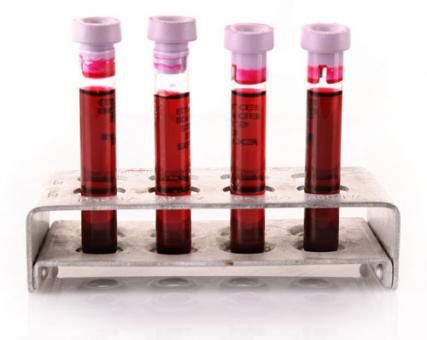 Плазменный реактив - SHK256-4G - BBI Enzymes  - для исследований / VHB / человеческого происхождения