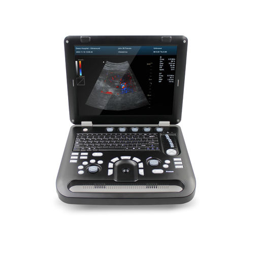 Переносной ультразвуковой сканер - CMS1700C  - Contec Medical Systems - для эхографии в акушерстве и гинекологии / для брюшной и тазовой эхографии / цветовой допплер