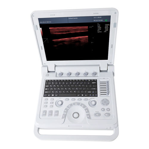 Переносной ультразвуковой сканер - CMS600P2PLUS - Contec Medical Systems - для эхографии в акушерстве и гинекологии / для брюшной и тазовой эхографии / для урологической эхографии