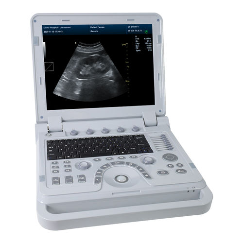 Переносной ветеринарный ультразвуковой сканер - CMS1700A-VET - Contec Medical Systems - многоцелевой / черно-белый / цветовой допплер