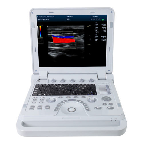 Переносной ультразвуковой сканер - CMS1700A  - Contec Medical Systems - для поливалентной эхографии / для эхографии в акушерстве и гинекологии / для брюшной и тазовой эхографии
