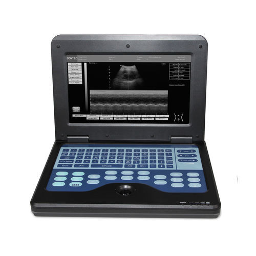 Переносной ультразвуковой сканер - CMS600P2  - Contec Medical Systems - для эхографии в акушерстве и гинекологии / для урологической эхографии / для сердечно-сосудистой эхографии