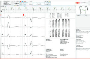 Алгоритм для диагностики - ECG algorithms - Corscience GmbH & Co. KG - для анализа / для ЭКГ