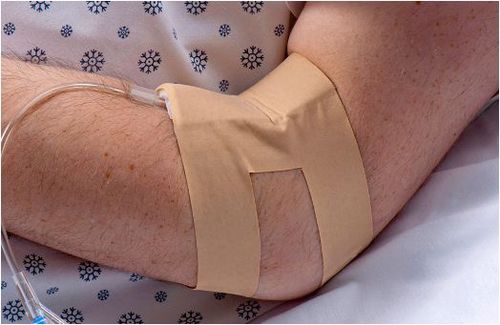 Фиксатор внутривенного катетера - IV-ARMOR®  - Dale Medical Products - рука / клейкий
