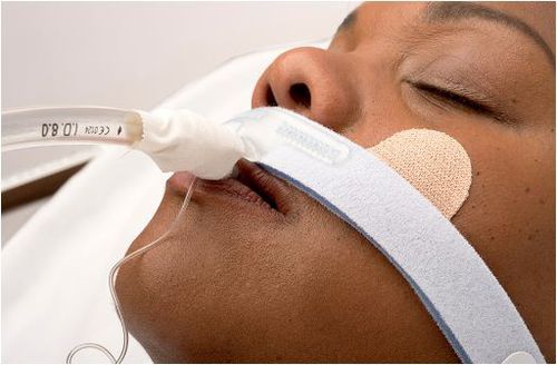 Фиксатор эндотрахеальной трубки - Stabilock - Dale Medical Products - голова / клейкий