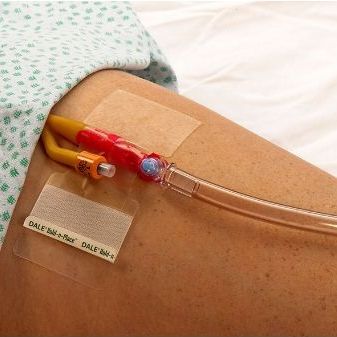 Фиксатор мочевого катетера - Hold-n-Place&reg; - Dale Medical Products - нога / клейкий