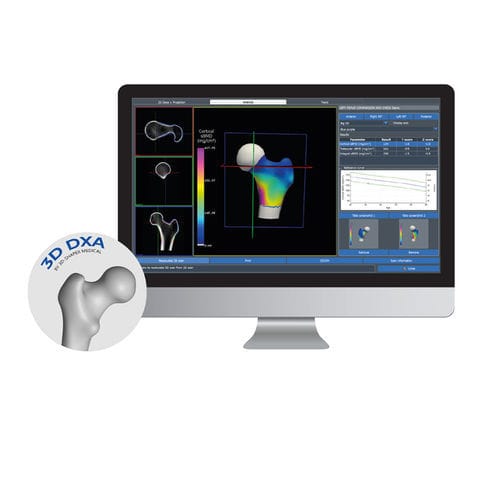 Программное обеспечение для визуализации 3D - 3D-DXA - DMS Imaging - для остеоденситометрии