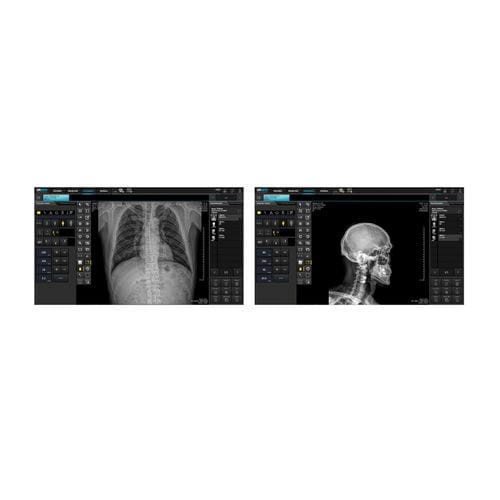 Программное обеспечение для визуализации DICOM - DRGEM  - для печати / для рентгенологии