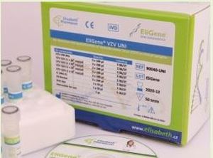 Набор для теста на энцефалит - EliGene® TBEV LC  - Elisabeth Pharmacon spol  - для исследований / для вируcов / клинический