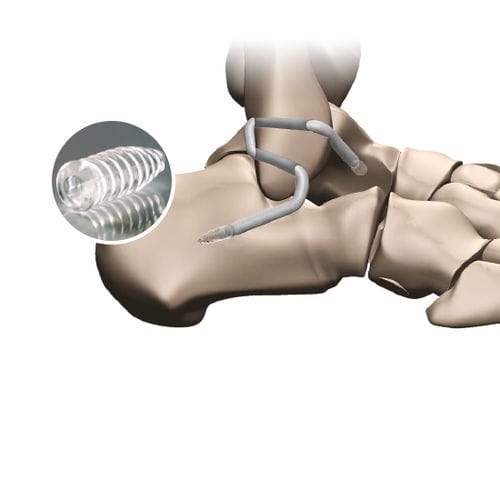Лигаментарный протез тонкое сухожилие - 267 596 - FH Orthopedics - синтетический