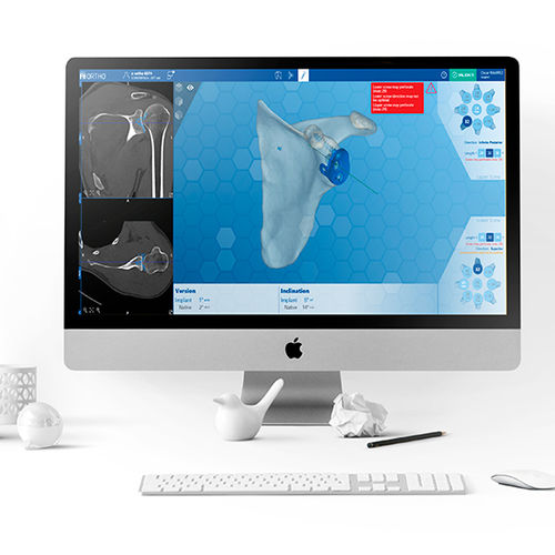 Программное обеспечение для хирургии плечевого сустава - e-Ortho - FH Orthopedics - для визуализации 3D / для проверки протеза / анатомическое