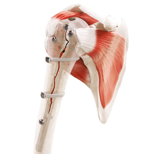 Ортопедическая проволока для перипротезного перелома - Strapflex - FH Orthopedics - полимерная комплексная нить