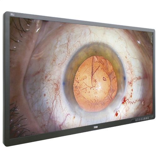 Медицинский монитор - FM-A5505DGC - FSN Medical Technologies - для эндоскопии / хирургический / Full HD