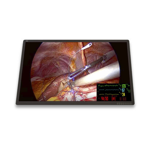 Медицинский монитор - FM-C5501DV - FSN Medical Technologies - хирургический / 3840×2160 / 55"