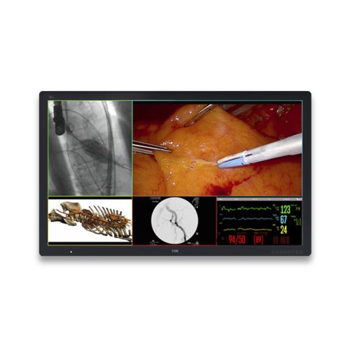 Медицинский монитор - FM-D5802DV - FSN Medical Technologies - хирургический / для медицинских снимков / для диагностики