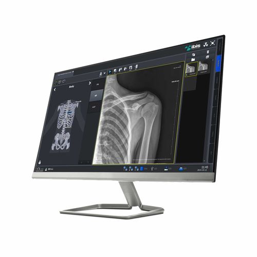 Программное обеспечение визуализатор - IBIS X Ray Systems - рентгенографии / для планшетного ПК
