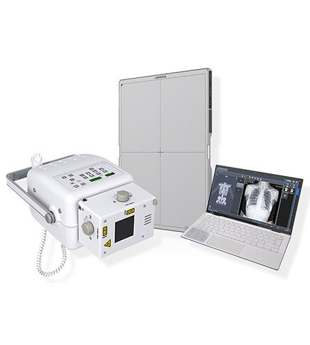 Цифровой рентгенографическая система - Home Ray - IBIS X Ray Systems - для многофункциональной радиографии / без стола / переносной