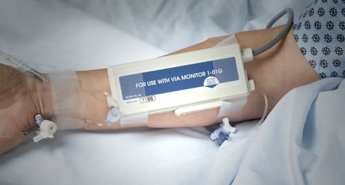 Глюкометр непрерывного действия - GlucoScout® - International Biomedical 