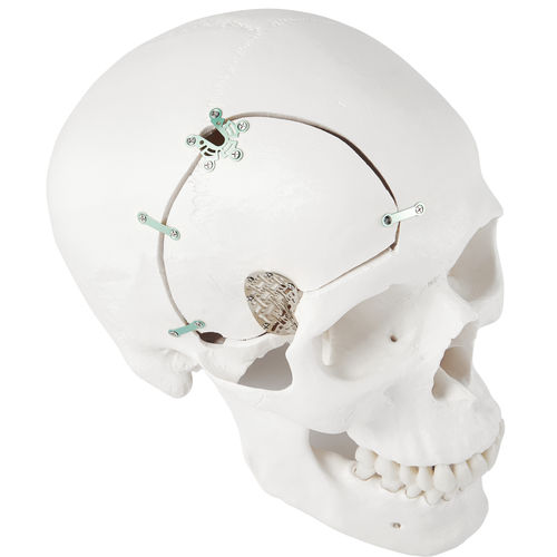 Система фиксации костного лоскута нерассасывающаяся - LeForte Neuro 0.3 - Jeil Medical Corporation