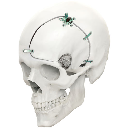 Система фиксации костного лоскута нерассасывающаяся - LeForte Neuro 0.6 - Jeil Medical Corporation