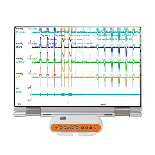 Переносной монитор пациента - Solar™ Go  - Laborie Medical Technologies - манометрии / для интенсивной терапии / для взрослых