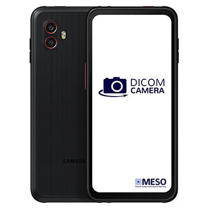 Камера для дерматоскопов - DICOM Camera Compact - MESO - цифровая / Full HD / CMOS