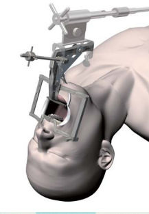Фарингоскоп для взрослых - Satou - Nagashima Medical Instruments - с прямым углом