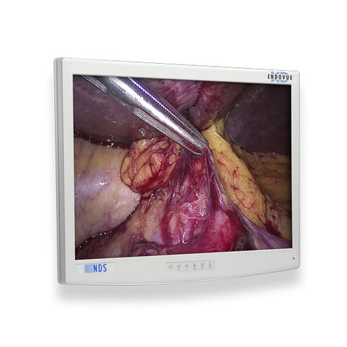 Медицинский монитор - EndoVue®  - NDS Surgical Imaging - для медицинских снимков / для эндоскопии / хирургический