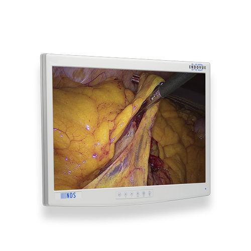 Медицинский монитор - EndoVue®  - NDS Surgical Imaging - для медицинских снимков / для эндоскопии / хирургический