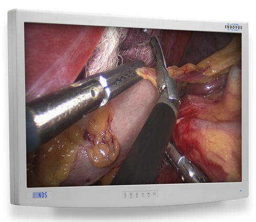 Медицинский монитор - EndoVue®  - NDS Surgical Imaging - для медицинских снимков / для эндоскопии / с высоким разрешением