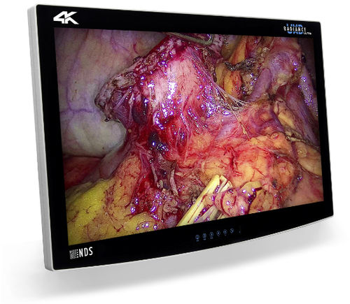 Медицинский монитор - RADIANCE® ULTRA - NDS Surgical Imaging - хирургический / разрешение 4K / 32"