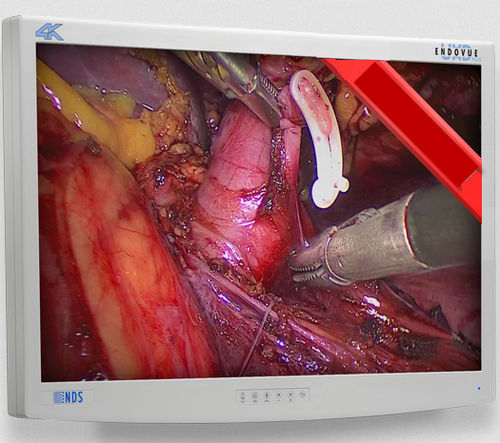 Медицинский монитор - EndoVue Plus  - NDS Surgical Imaging - для эндоскопии / с высоким разрешением / 32"