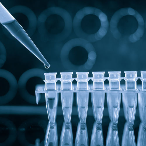 Набор для теста для болезней, передаваемых половым путем - QP10704 - Randox Laboratories - на гонококк / Хламидиоз / для ОТ-ПЦР