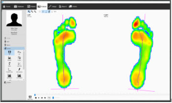 Программное обеспечение для лечения заболеваний стоп - v9 Essentials - Materialise - для анализа / для измерений / для обмена информацией