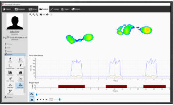 Программное обеспечение для лечения заболеваний стоп - v9 Scientific - Materialise - для анализа / для измерений / для обмена информацией