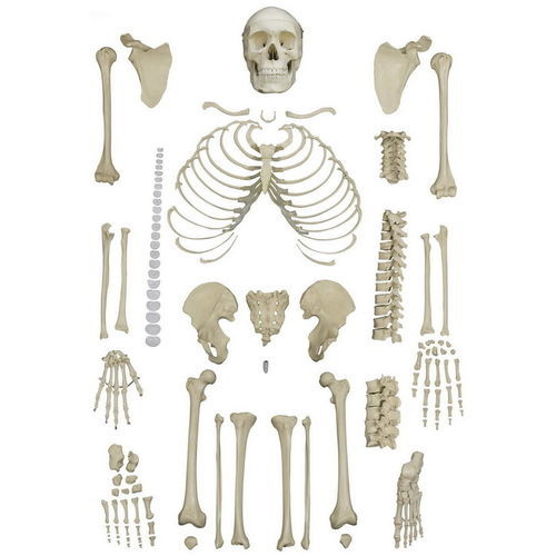 Анатомическая модель скелета - A202 - RÜDIGER - ANATOMIE  - для образовательных целей / вывихнутая