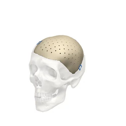 Черепной имплантат на заказ - Cranial iD - Stryker