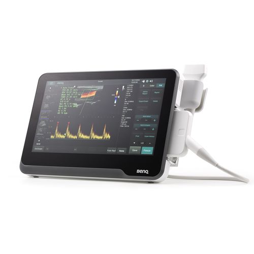 Переносной ультразвуковой сканер - T3300 - BenQ Medical Technology - для поливалентной эхографии / черно-белый / цветовой допплер