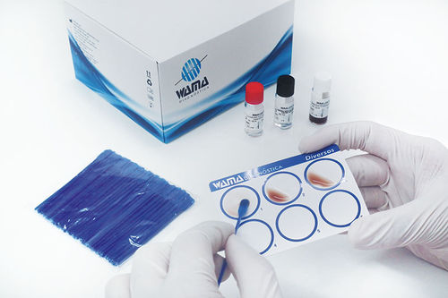 Реактив в растворе - Wama Diagnostica - для лабораторий / IgG / на ревматоидный фактор