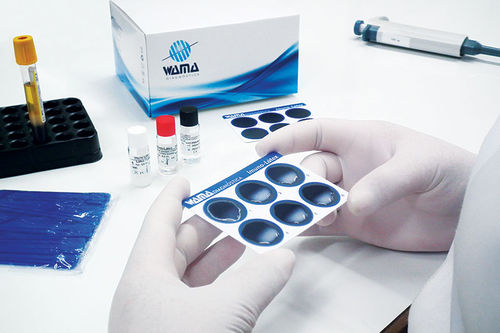 Реактив в растворе - Wama Diagnostica - для иммуноанализа / CRP / на ревматоидный фактор