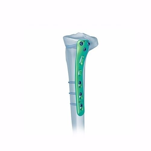 Компрессионная костная пластина большеберцовая кость - Double Medical Technology - проксимальная / заднемедиальная / блокируемая