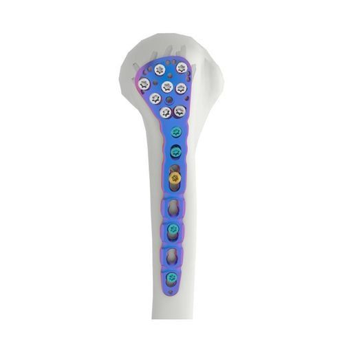 Компрессионная костная пластина плечевая кость - VAL - Double Medical Technology - проксимальная / блокируемая