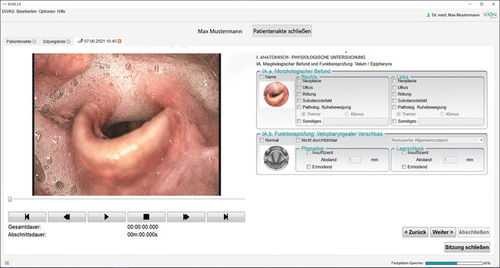 Программное обеспечение для диагностики - Dysphagia - XION medical - для оценки / медицинское / для медицинского обследования
