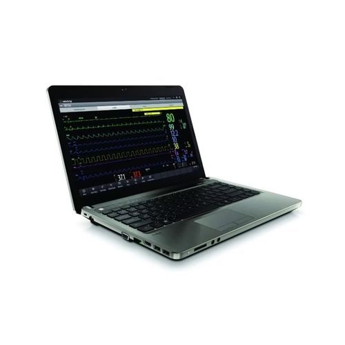 Программное обеспечение визуализатор - BeneVision CMS  - Mindray North America - управление рабочим процессом ECG в режиме онлайн / с сигналом тревоги / для личных дел пациентов