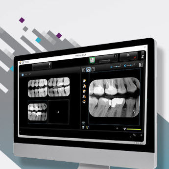 Программное обеспечение для визуализации - CS Imaging version 8 - Carestream Dental - для управления данными / для управления данными пациента / для диагностики