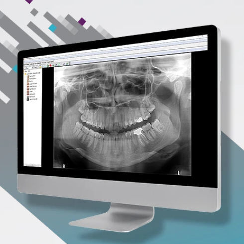 Программное обеспечение для визуализации - OMS - Carestream Dental - для анализа / для диагностики / для составления отчетности