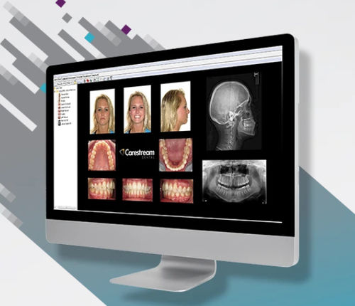 Программное обеспечение для визуализации - CS Orthodontic Imaging Software - Carestream Dental - для управления данными / для управления данными пациента / для диагностики