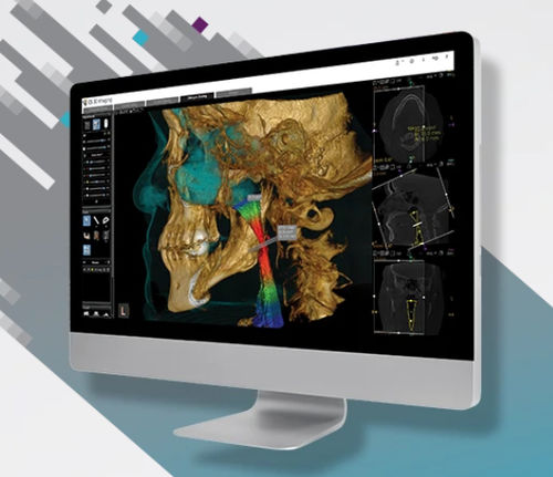 Модуль программного обеспечения для визуализации 3D - CS Airway Module - Carestream Dental - для контурной обработки / для определения контуров / для измерений