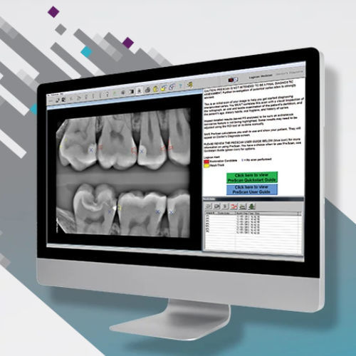Программное обеспечение для выявления кариеса - Logicon Caries Detector - Carestream Dental - для визуализации / для анализа / для управления данными